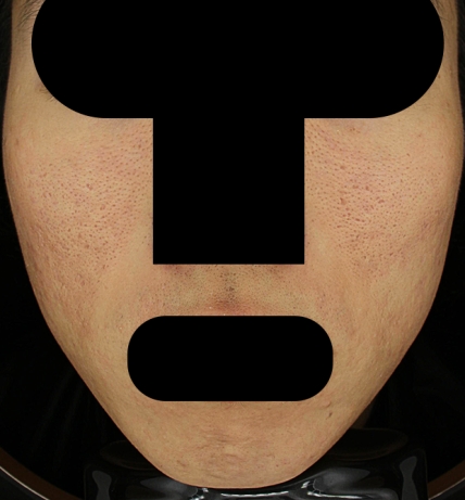 치료후기 이미지