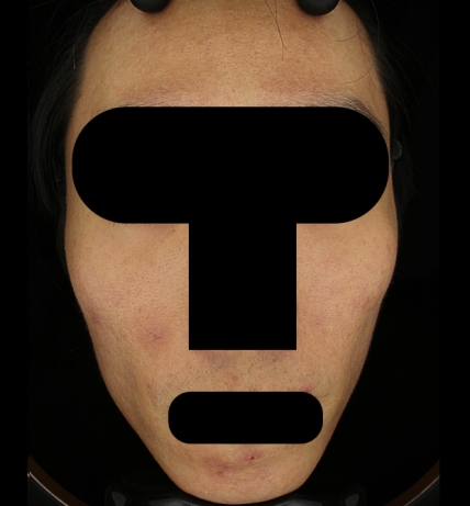 치료후기 이미지