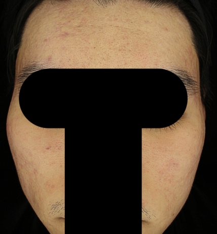 치료후기 이미지