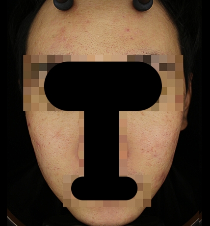 치료후기 이미지