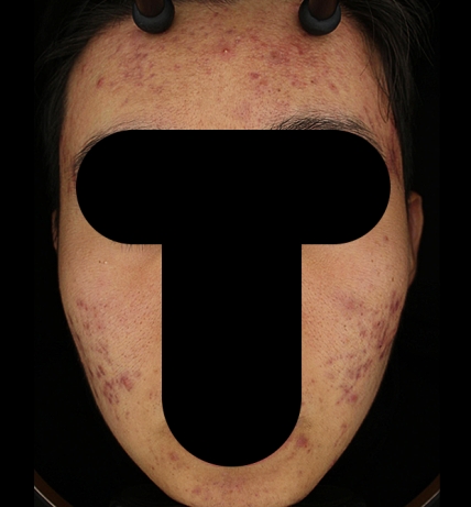 치료후기 이미지