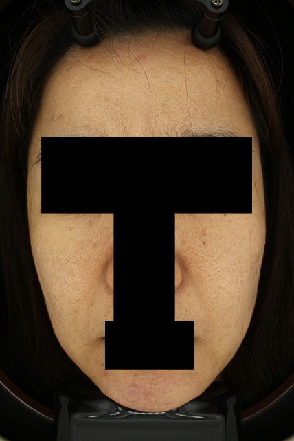 치료후기 이미지