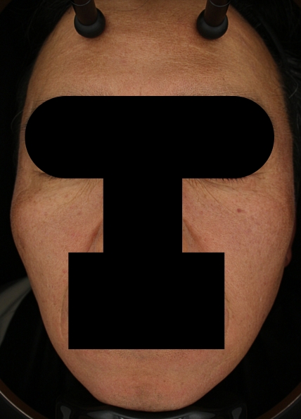 치료후기 이미지