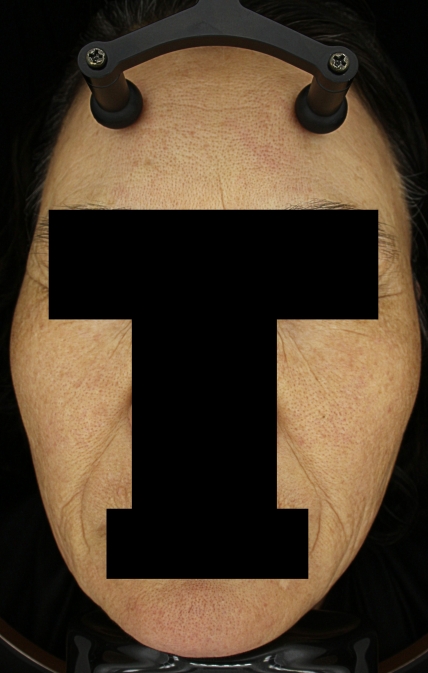 치료후기 이미지