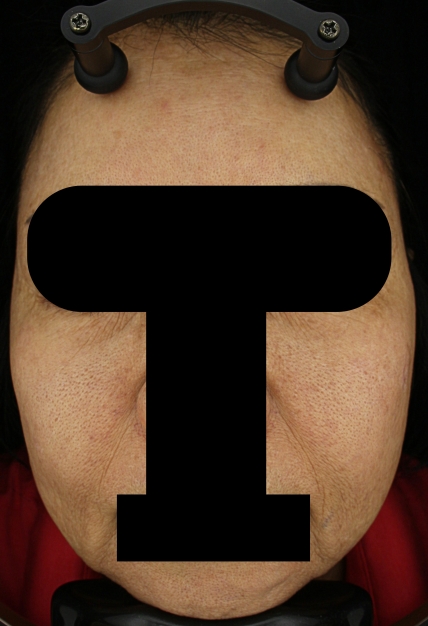 치료후기 이미지