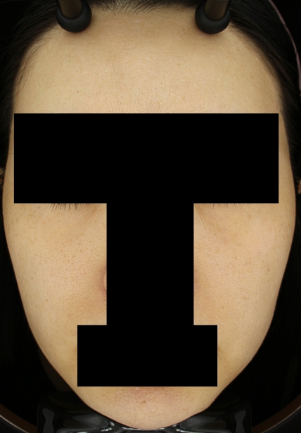 치료후기 이미지