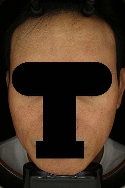 치료후기 이미지