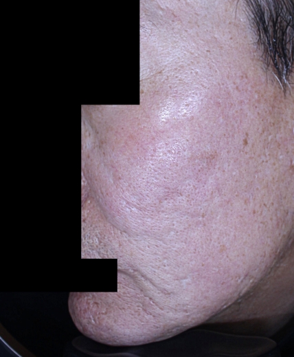 치료후기 이미지