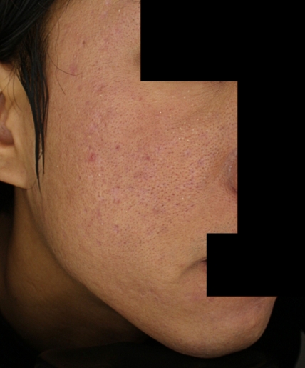 치료후기 이미지