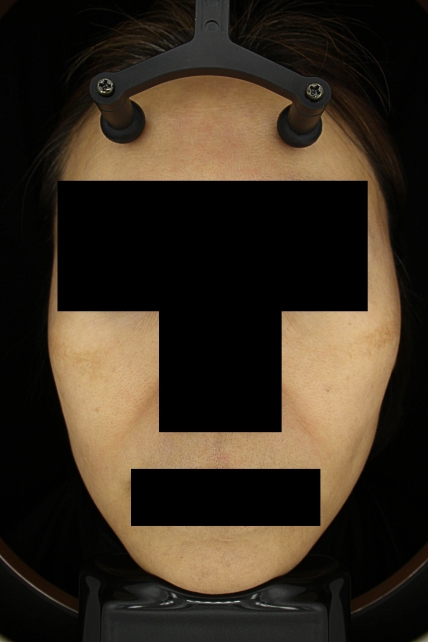 치료후기 이미지