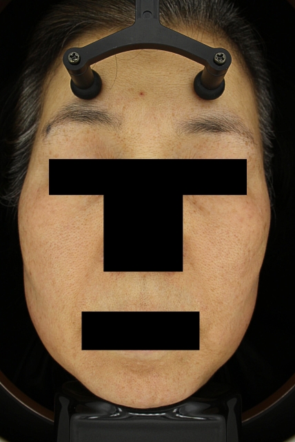 치료후기 이미지