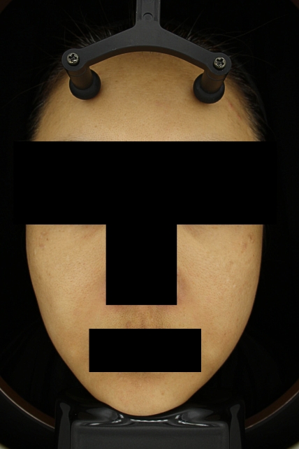 치료후기 이미지