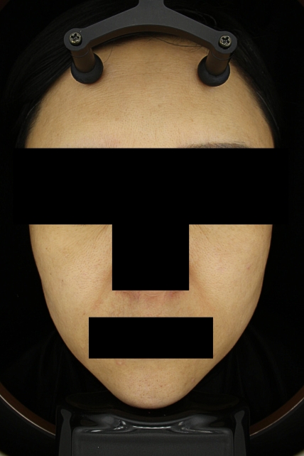 치료후기 이미지