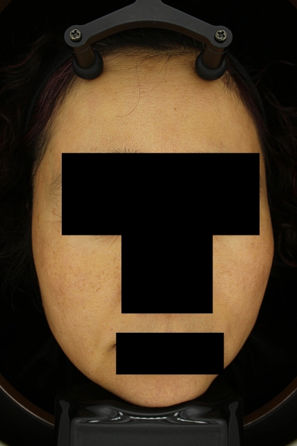 치료후기 이미지