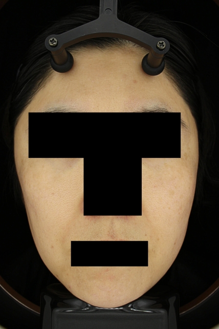 치료후기 이미지