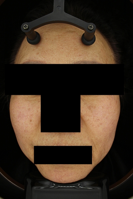 치료후기 이미지