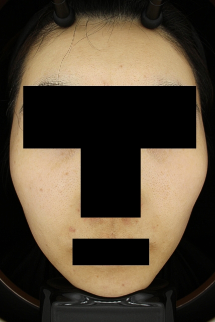 치료후기 이미지