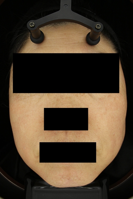 치료후기 이미지