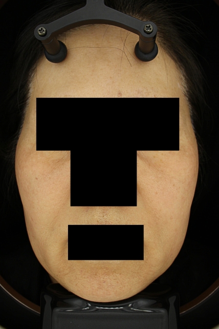 치료후기 이미지