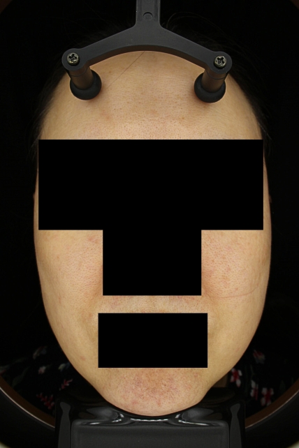 치료후기 이미지