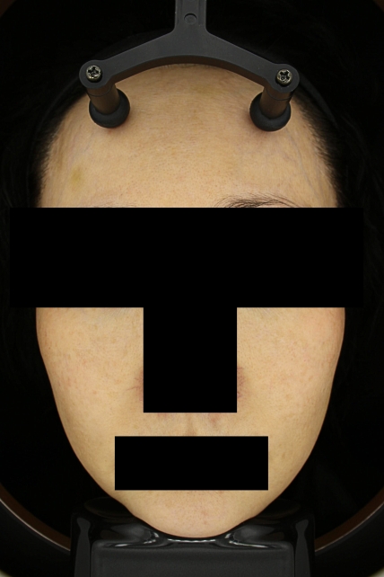 치료후기 이미지