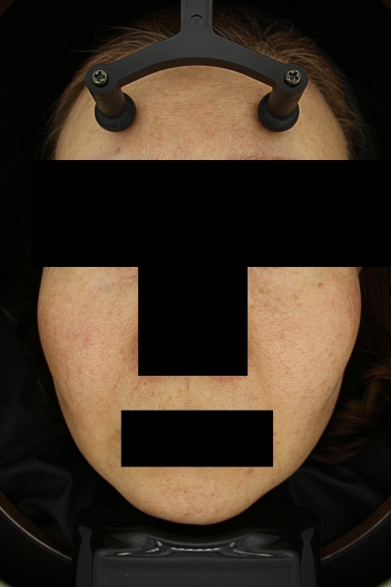 치료후기 이미지