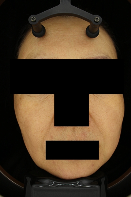 치료후기 이미지