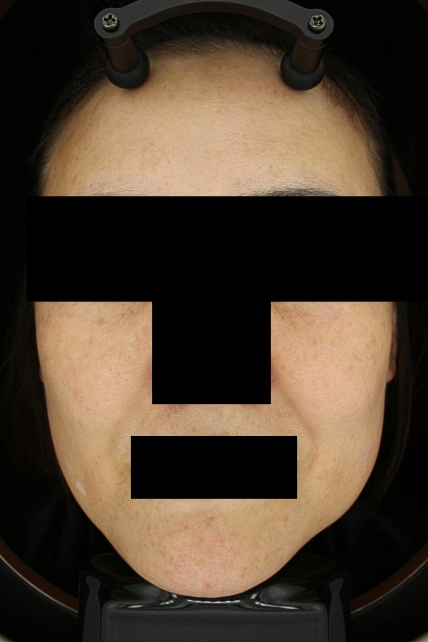 치료후기 이미지