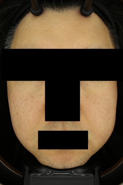 치료후기 이미지