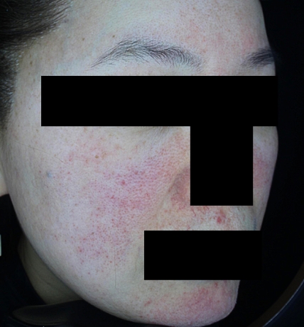 치료후기 이미지