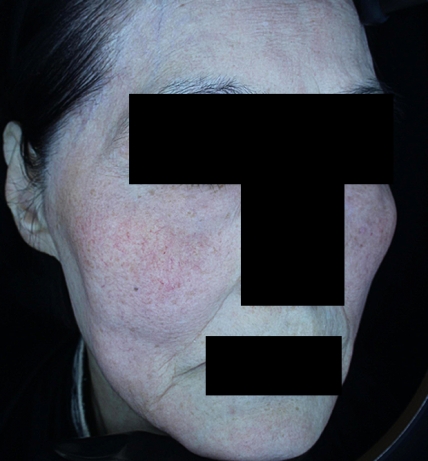 치료후기 이미지