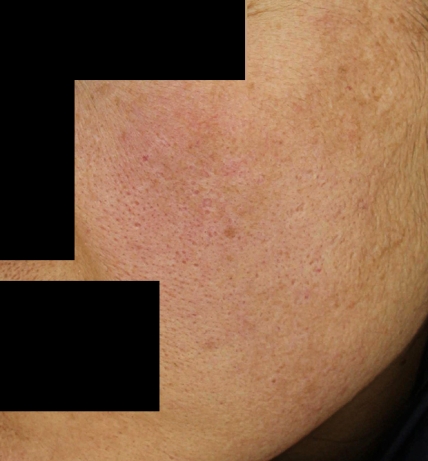 치료후기 이미지