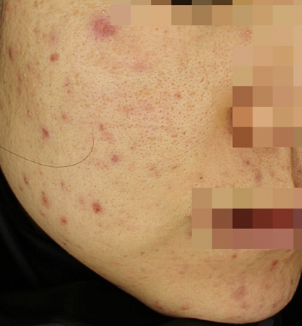 치료후기 이미지