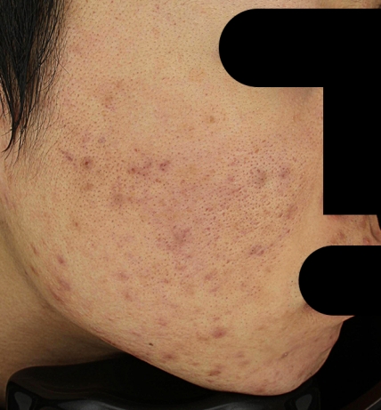 치료후기 이미지