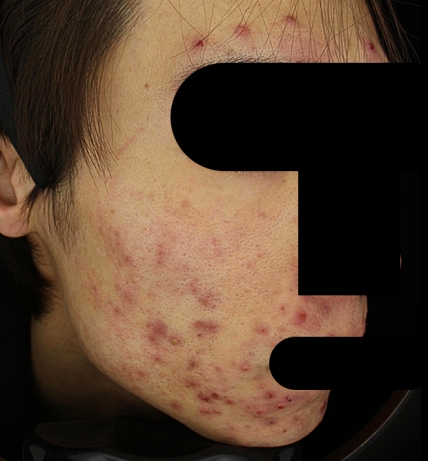 치료후기 이미지