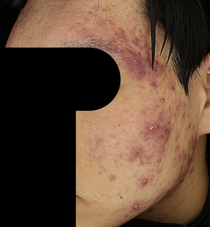 치료후기 이미지