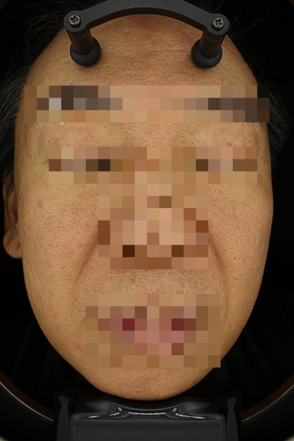 치료후기 이미지