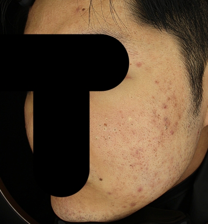 치료후기 이미지