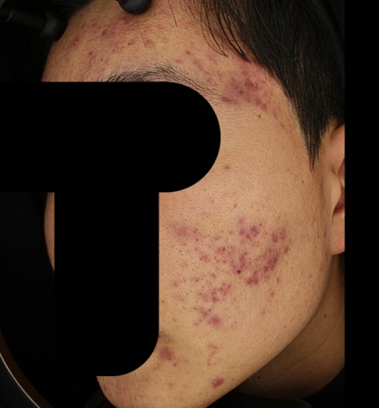 치료후기 이미지