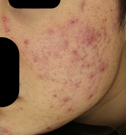 치료후기 이미지