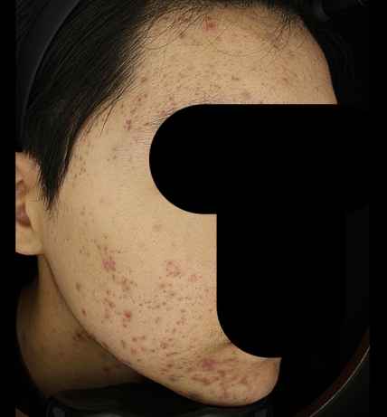 치료후기 이미지