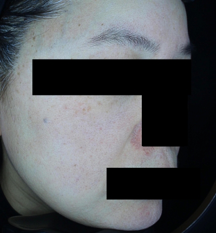 치료후기 이미지