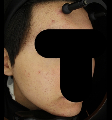 치료후기 이미지