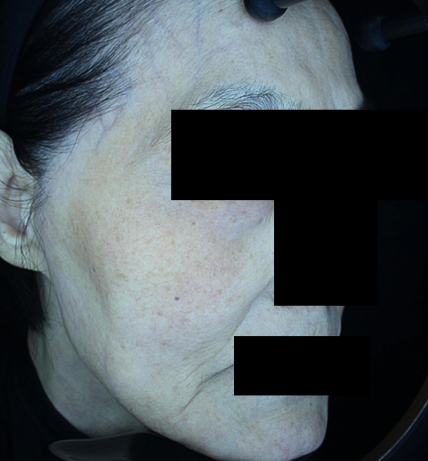 치료후기 이미지