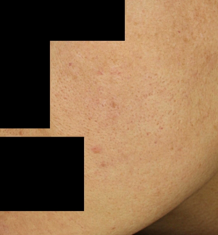 치료후기 이미지