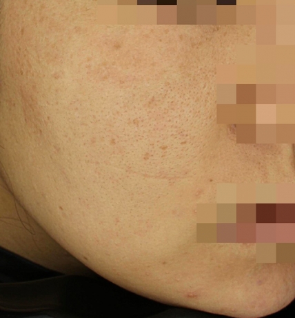 치료후기 이미지