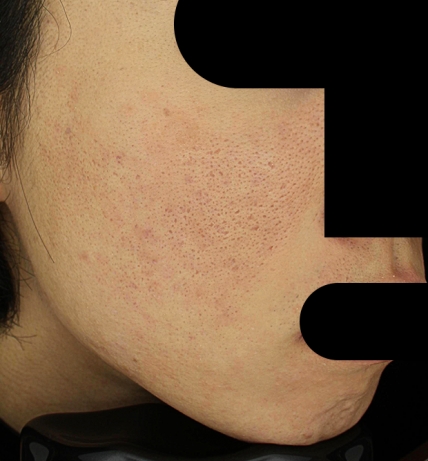 치료후기 이미지