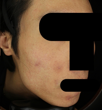 치료후기 이미지