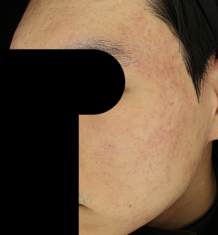 치료후기 이미지