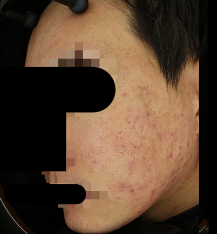 치료후기 이미지